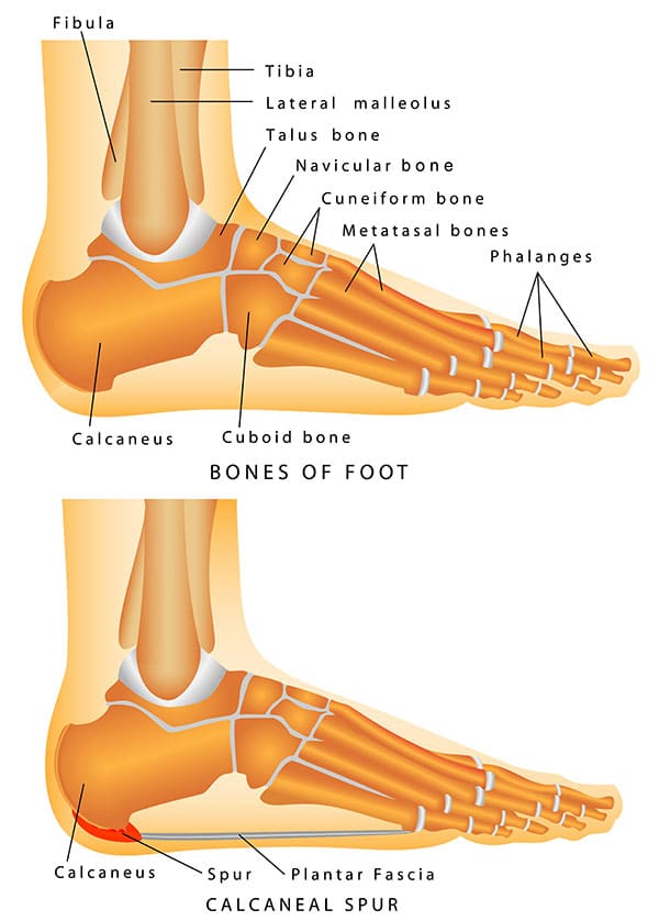 Bone Spurs North York And Toronto Foot Doctor